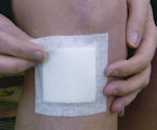 Adhesive Dressings - Sterile : Click for more info.